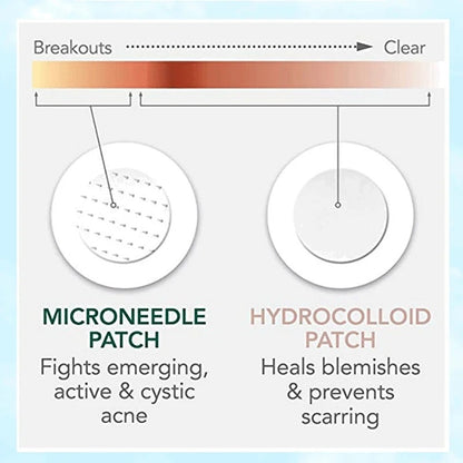 Microneedle Soluble Hyaluronic Acid (9PCs)