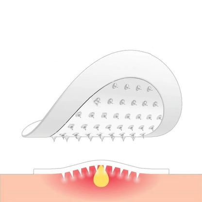 Microneedle Soluble Hyaluronic Acid (9PCs)